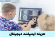 هزینه ایمپلنت دیجیتال در تهران