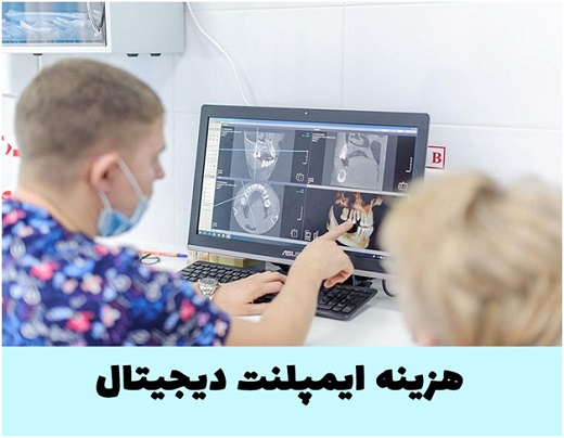 هزینه ایمپلنت دیجیتال در تهران